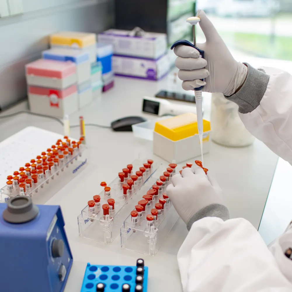 Onderzoeker met pipet en monster op het lab